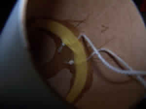 LOC Cyclotron - Shock Cord Mount